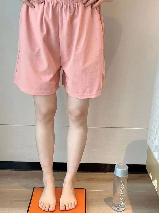 断腿体重还是不掉？真相扎心了…pg电子模拟器试玩每天吃草跑(图3)